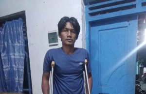 20 Tahun Kehilangan Kaki, Iskandar di Tegal Berharap Bantuan Kaki Palsu dari Pemkab
